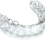 Fastbraces® Retainers are clear and made from durable thermoplastic that is custom fit to the patients’ mouth