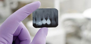 endodontist-examining-xray